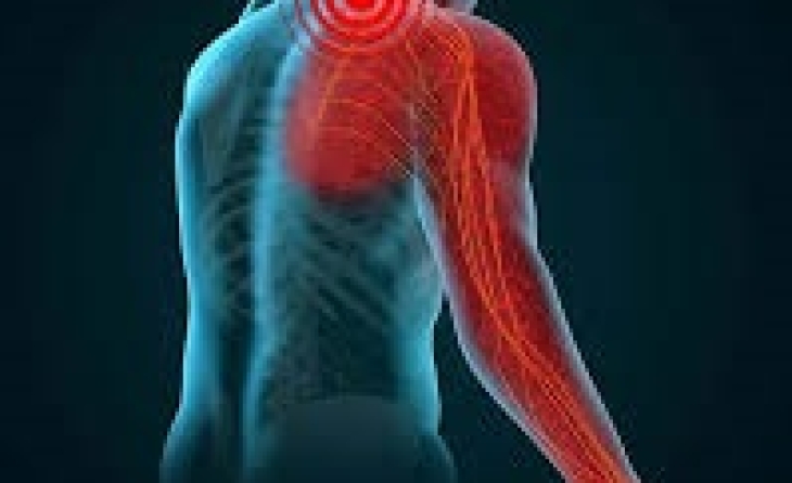 Αυχενική ριζίτιδα - Επισκληρίδιος έγχυση